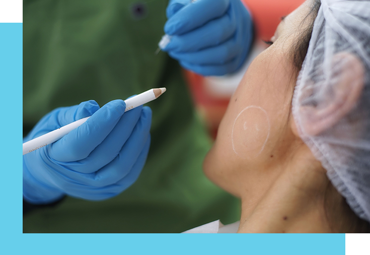 Facial Rejuvenation Treatments in Windsor