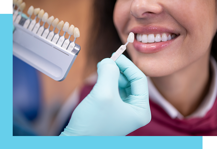 porcelain veneers aftercare
