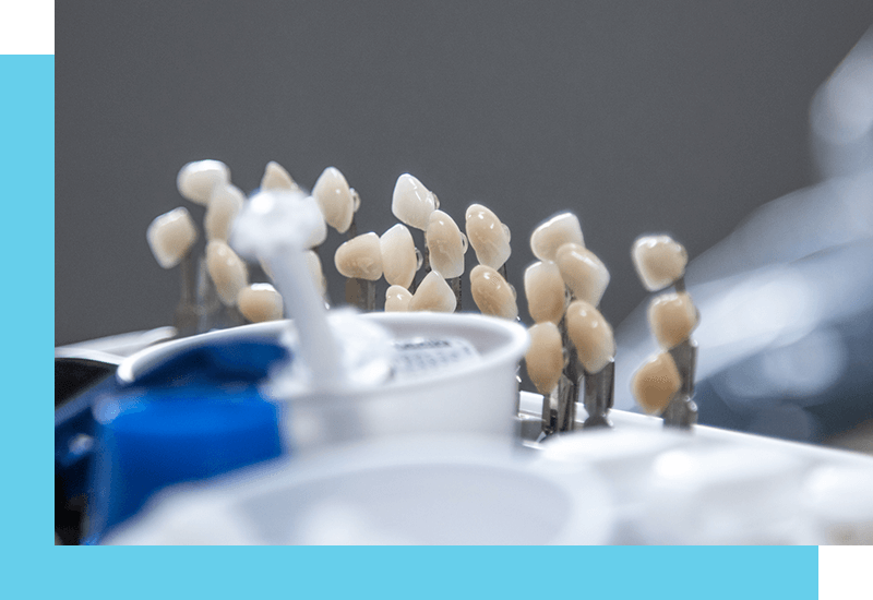 Restorative dental crowns in Dane County